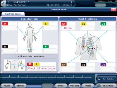 Electrocardiografo de 12-15 Canales